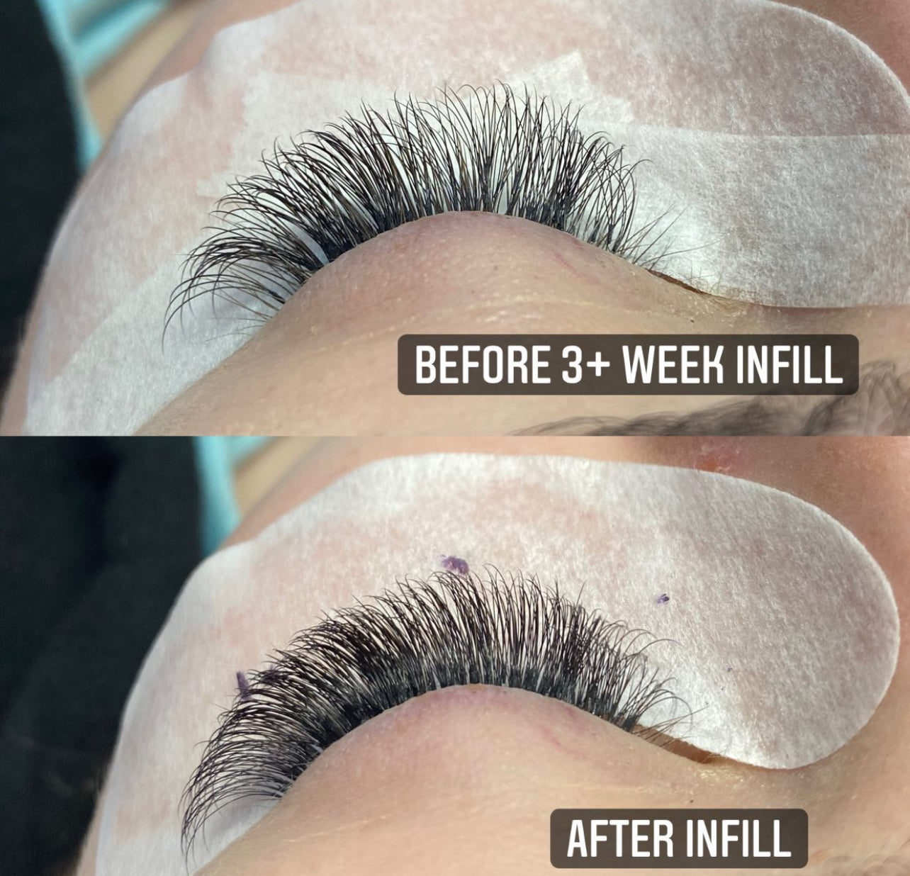 3 Week Infill
